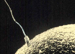 Normal_sperm-egg