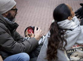 Groep van zestig medici uit ernstige zorgen over politiegeweld in Amsterdam